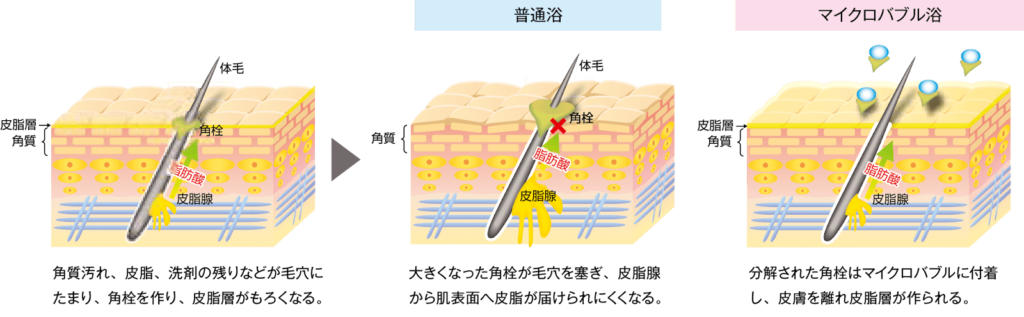マイクロバブル浴